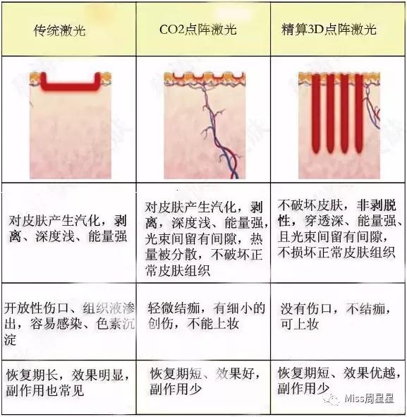 星空体育官方网站:十大热门光子嫩肤仪排行榜光子嫩肤美容仪品牌产品推荐→买购网(图1)