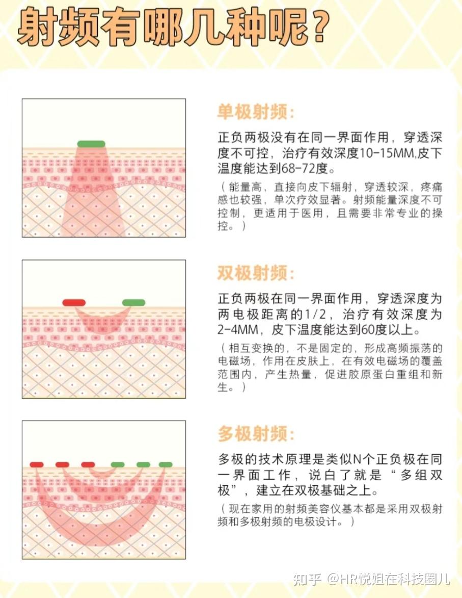 射频美容仪到底是黑科技还是智商税?(图1)