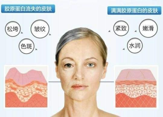皮肤射频的作用和功效是什么(图1)