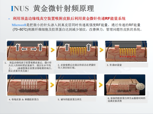 星空体育集团股份有限公司:脉冲和射频美容仪的区别是什么(图1)